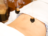 野田市の鍼灸院